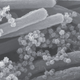 An image of SARS-COV-2 virions infecting the cells that line the airways of our lungs. This image is at 100 nanometers, or 10 times closer than the top image.